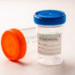 Essenzial Urine Container